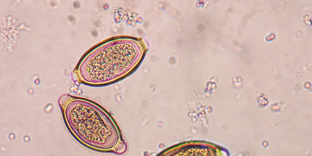 Ne dozvolite da paraziti vladaju vašom psihom