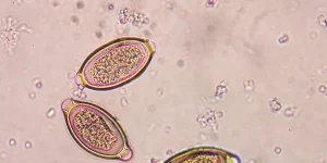 Ne dozvolite da paraziti vladaju vašom psihom